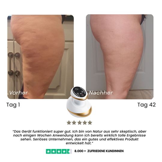 CelluSmooth™ - Anti-Cellulite Massagegerät